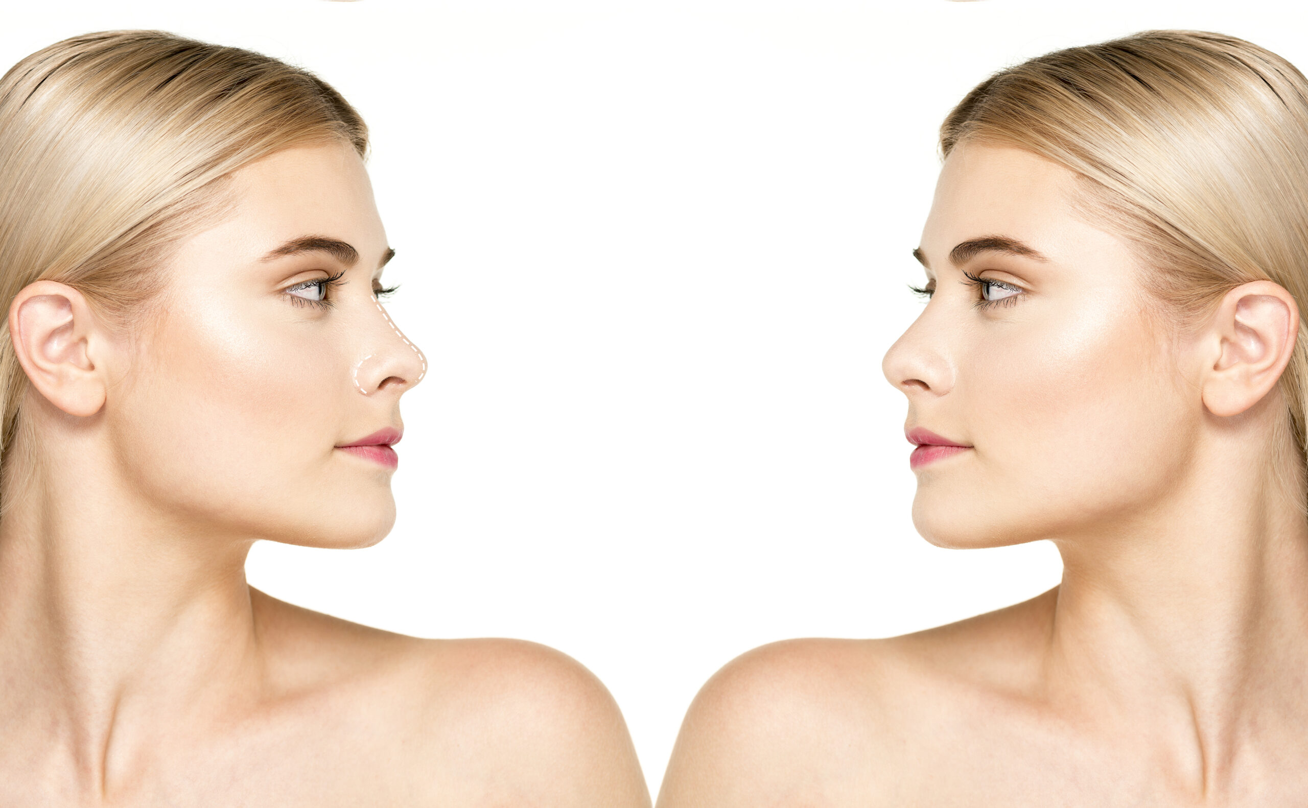 Full vs Mini Facelift