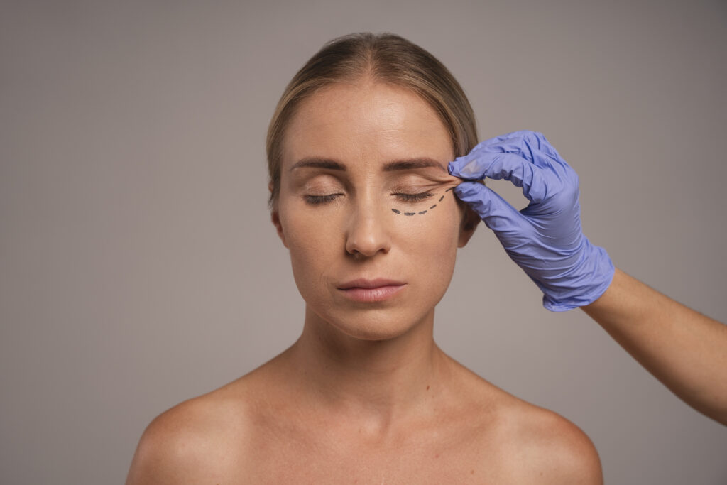 Upper vs. Lower Eyelid Surgery