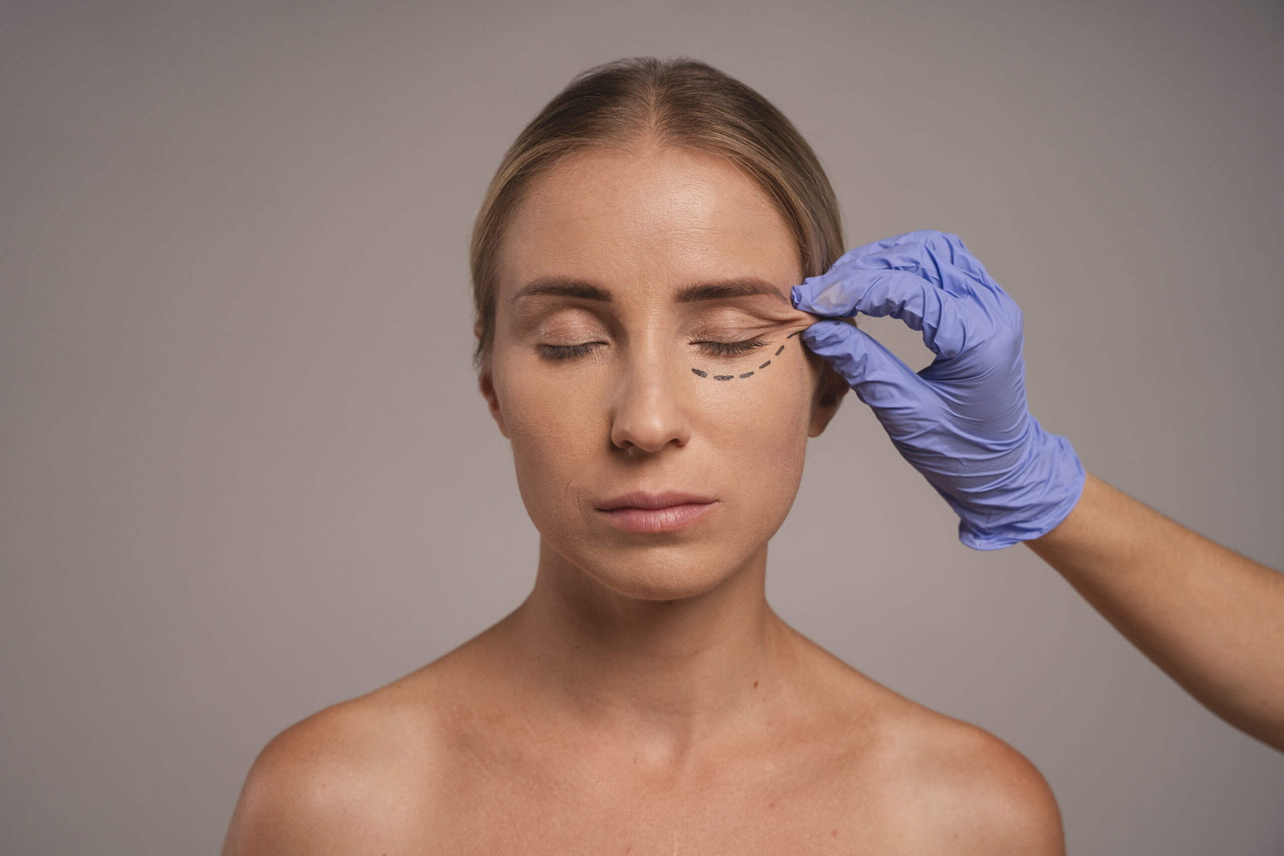 Upper vs. Lower Eyelid Surgery