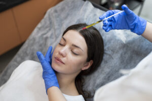 Microneedling with PRP