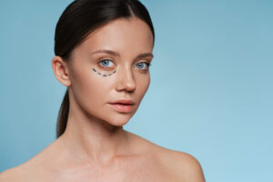 Blepharoplasty