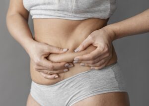 Abdominoplasty