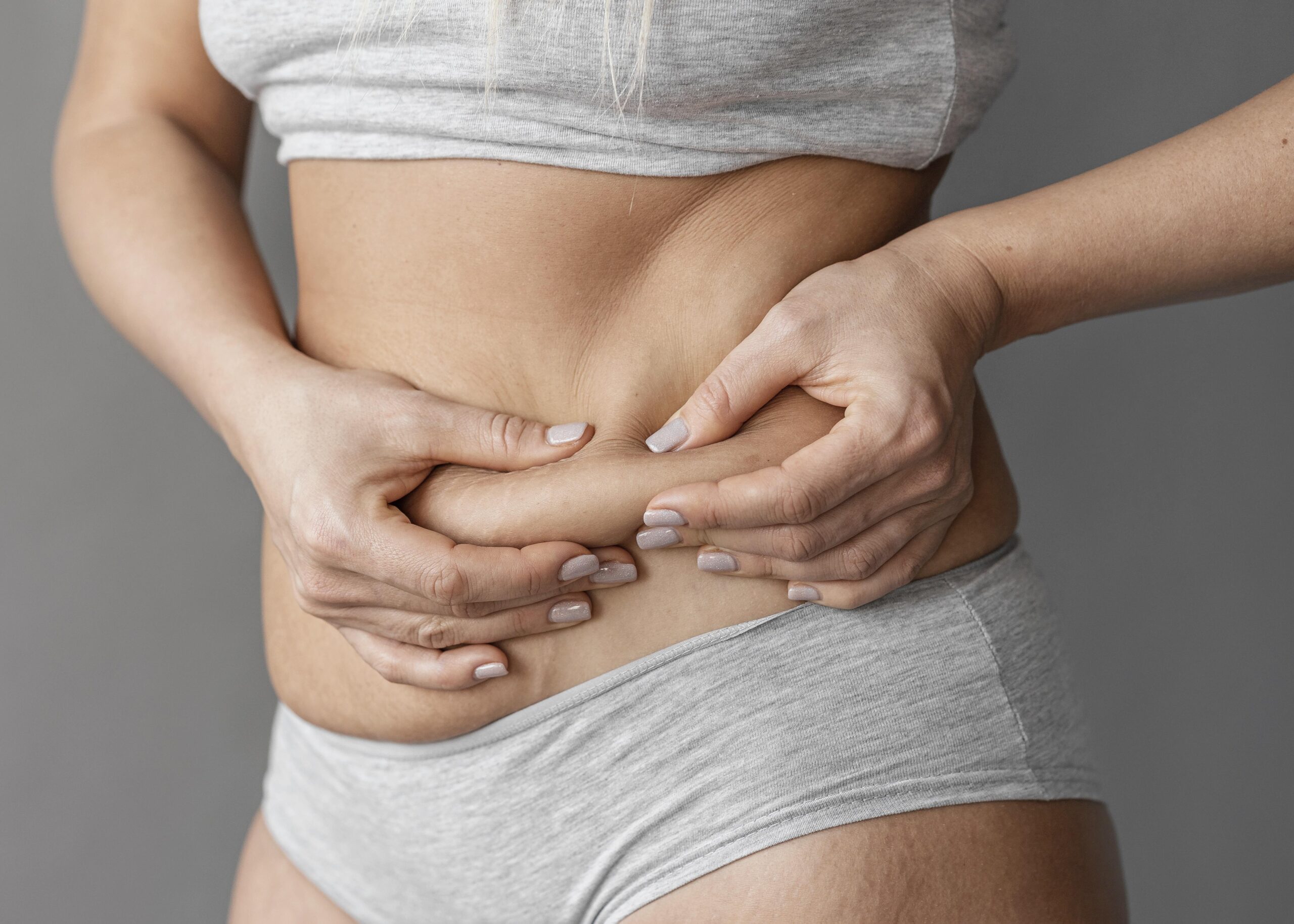 Abdominoplasty