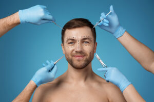 Male facelift