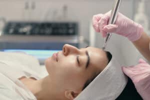 PRP vs. Exosomes in microneedling