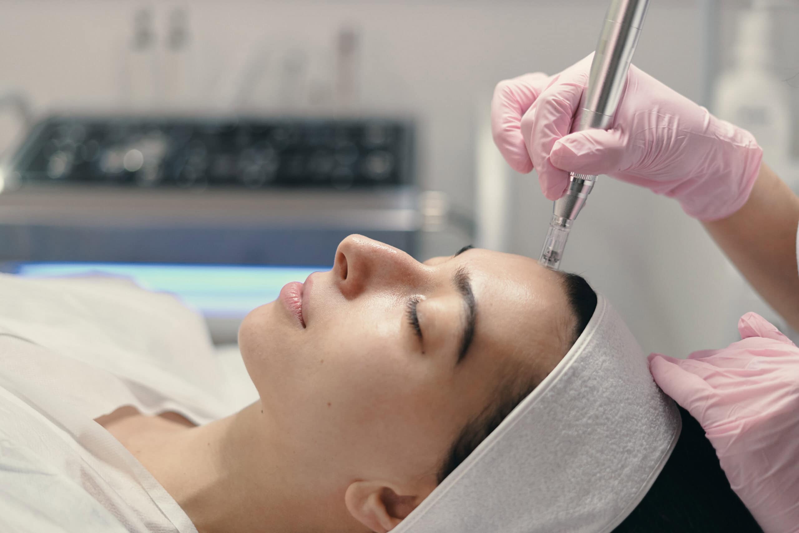 PRP vs. Exosomes in microneedling